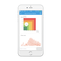 IHealth VIEW BP7s inteligentny ciśnieniomierz nadgarstkowy